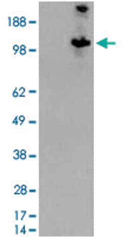 TSC1, Goat, Polyclonal Antibody, Abnova 100 &mu;g | Buy Online | Abnova Corporation | Fisher Scientific