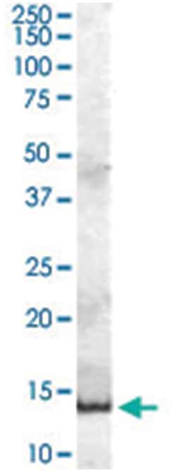 PIP, Goat, Polyclonal Antibody, Abnova 100 &mu;g | Buy Online | Abnova Corporation | Fisher Scientific