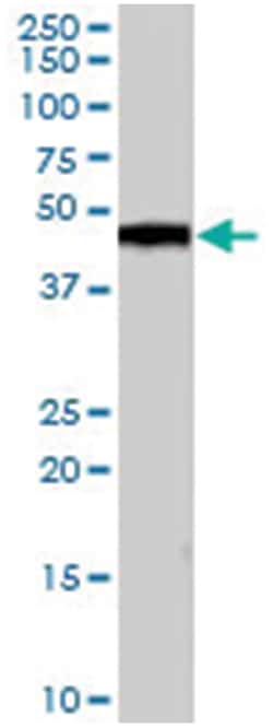 CSNK1D, Goat, Polyclonal Antibody, Abnova 100 &mu;g | Buy Online | Abnova Corporation | Fisher Scientific