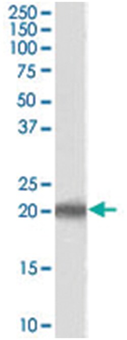 PERP, Goat, Polyclonal Antibody, Abnova 100&mu;g; Unlabeled:Antibodies,