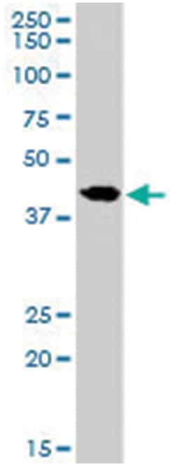 SLC24A5, Goat, Polyclonal Antibody, Abnova 100&mu;g; Unlabeled:Antibodies,