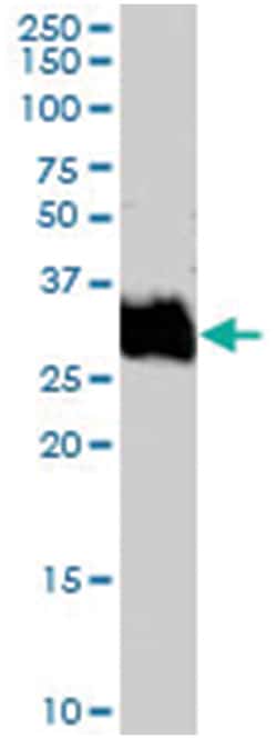 FOSL1, Goat, Polyclonal Antibody, Abnova 100 &mu;g | Buy Online | Abnova Corporation | Fisher Scientific