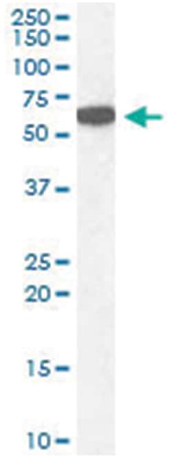 CAT, Goat, Polyclonal Antibody, Abnova 100 &mu;g | Buy Online | Abnova Corporation | Fisher Scientific