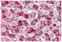 CAT, Goat, Polyclonal Antibody, Abnova 100 &mu;g | Buy Online | Abnova Corporation | Fisher Scientific