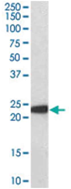 GPX1, Goat, Polyclonal Antibody, Abnova 100 &mu;g | Buy Online | Abnova Corporation | Fisher Scientific
