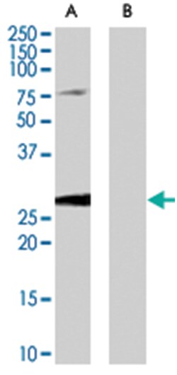 EBAG9, Goat, Polyclonal Antibody, Abnova 100&mu;g; Unlabeled:Antibodies,