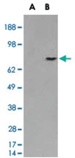 SILV, Goat, Polyclonal Antibody, Abnova 100&mu;g; Unlabeled:Antibodies,