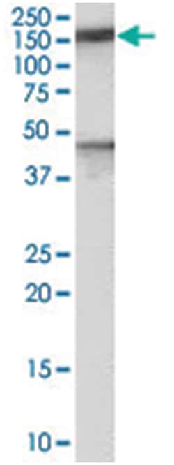 PTCH1 Goat anti-Human, Mouse, Polyclonal Antibody, Abnova 100 &mu;g | Buy Online | Abnova Corporation | Fisher Scientific