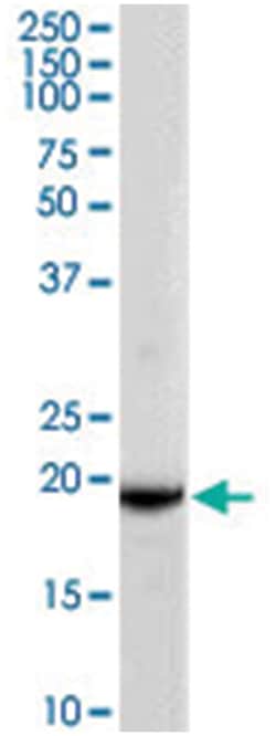 GPX4, Goat, Polyclonal Antibody, Abnova 100&mu;g; Unlabeled:Antibodies,