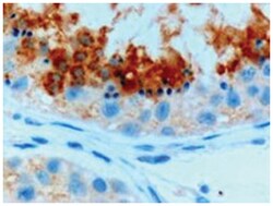 GPX4, Goat, Polyclonal Antibody, Abnova 100&mu;g; Unlabeled:Antibodies,