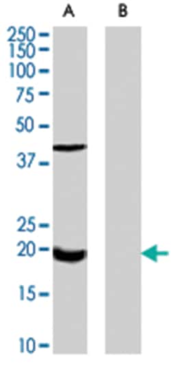 GPX7, Goat, Polyclonal Antibody, Abnova 100 &mu;g | Buy Online | Abnova Corporation | Fisher Scientific