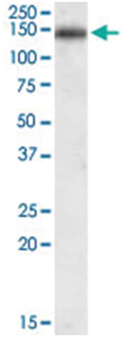 CILP, Goat, Polyclonal Antibody, Abnova 100 &mu;g | Buy Online | Abnova Corporation | Fisher Scientific