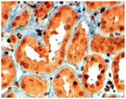 SEMA5A, Goat, Polyclonal Antibody, Abnova 100 &mu;g | Buy Online | Abnova | Fisher Scientific