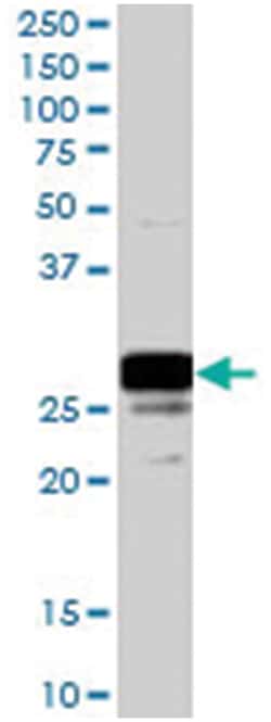 COMT Goat anti-Human, Polyclonal Antibody, Abnova 100&mu;g; Unlabeled:Antibodies,