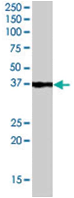 GBX2, Goat, Polyclonal Antibody, Abnova 100 &mu;g | Buy Online | Abnova Corporation | Fisher Scientific