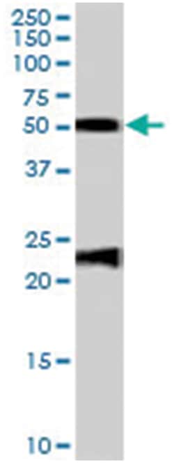 FBLN5, Goat, Polyclonal Antibody, Abnova 100&mu;g; Unlabeled:Antibodies,