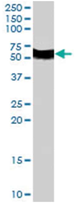 FBXL3, Goat, Polyclonal Antibody, Abnova 100&mu;g; Unlabeled:Antibodies,