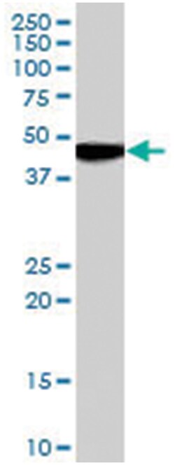 CHRM1, Goat, Polyclonal Antibody, Abnova 100&mu;g; Unlabeled:Antibodies,