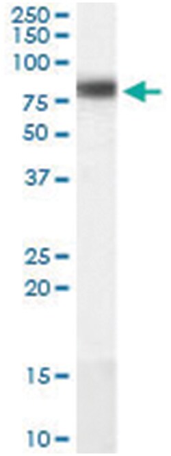 CPT1A, Goat, Polyclonal Antibody, Abnova 100 &mu;g | Buy Online | Abnova | Fisher Scientific