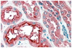 CPT1A, Goat, Polyclonal Antibody, Abnova 100 &mu;g | Buy Online | Abnova | Fisher Scientific