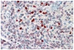 ALOX5AP Goat anti-Human, Polyclonal Antibody, Abnova 100 &mu;g | Buy Online | Abnova Corporation | Fisher Scientific