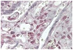 NHEJ1, Goat, Polyclonal Antibody, Abnova 100 &mu;g | Buy Online | Abnova | Fisher Scientific