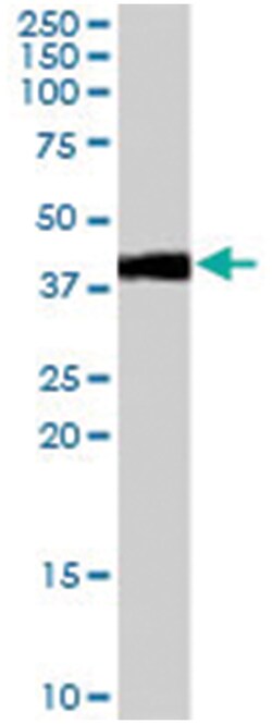 AGTR1, Goat, Polyclonal Antibody, Abnova 100 &mu;g | Buy Online | Abnova Corporation | Fisher Scientific