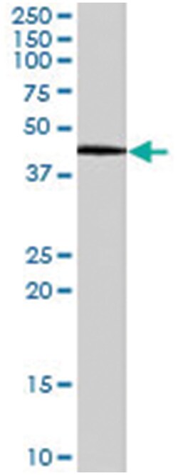 GATA5, Goat, Polyclonal Antibody, Abnova 100 &mu;g | Buy Online | Abnova Corporation | Fisher Scientific
