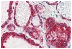 LPIN3, Goat, Polyclonal Antibody, Abnova 100 &mu;g | Buy Online | Abnova Corporation | Fisher Scientific