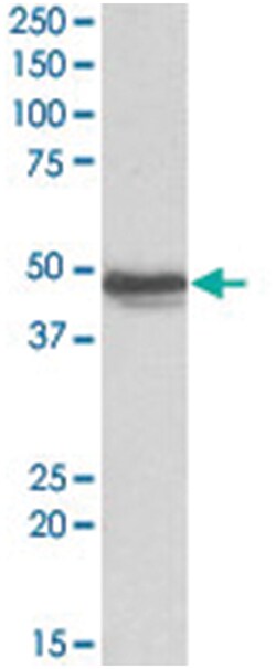 GFAP, Goat, Polyclonal Antibody, Abnova 100 &mu;g | Buy Online | Abnova | Fisher Scientific