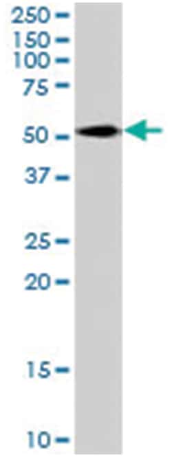 SLC7A11, Goat, Polyclonal Antibody, Abnova 100&mu;g; Unlabeled:Antibodies,