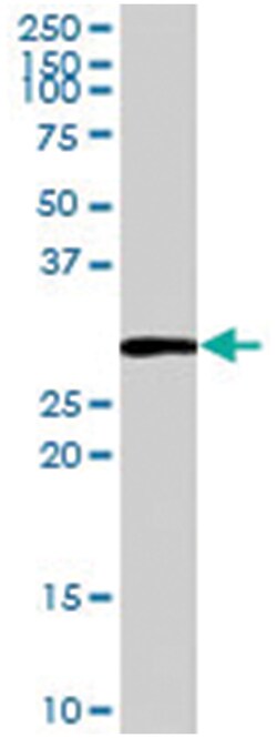 HOXB13, Goat, Polyclonal Antibody, Abnova 100&mu;g; Unlabeled:Antibodies,
