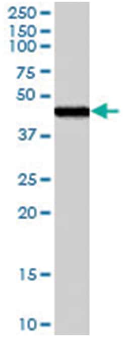 FEZ1, Goat, Polyclonal Antibody, Abnova 100&mu;g; Unlabeled:Antibodies,
