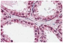 FOXP2 Goat anti-Human, Rat, Polyclonal Antibody, Abnova 100 &mu;g | Buy Online | Abnova Corporation | Fisher Scientific