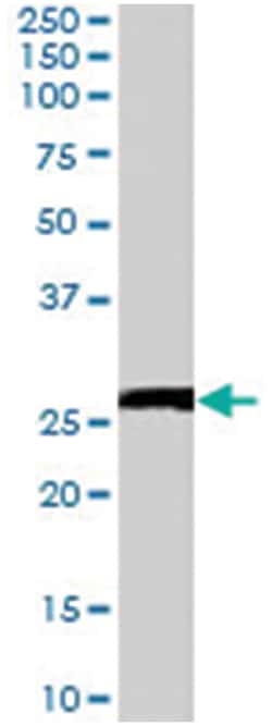GJB2, Goat, Polyclonal Antibody, Abnova 100 &mu;g | Buy Online | Abnova | Fisher Scientific