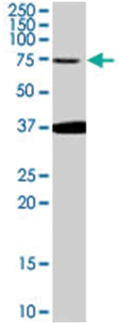 NEDD1, Goat, Polyclonal Antibody, Abnova 100 &mu;g | Buy Online | Abnova Corporation | Fisher Scientific