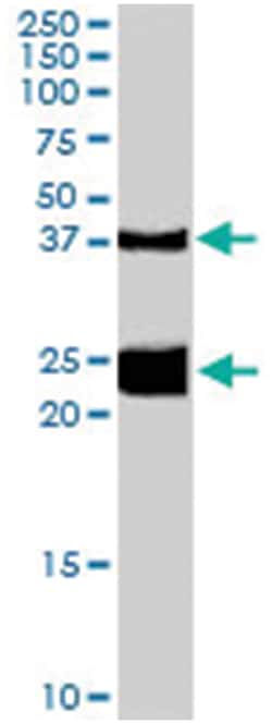 GALR1 Goat anti-Rat, Polyclonal Antibody, Abnova 100&mu;g; Unlabeled:Antibodies,