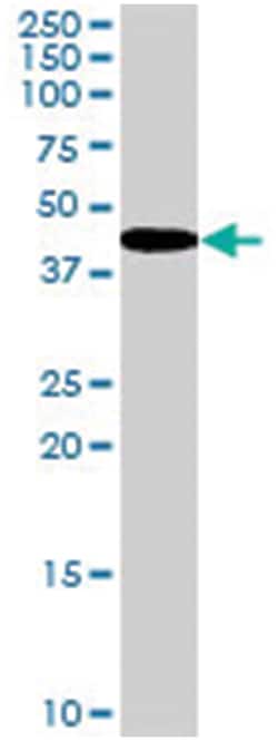 GALR2, Goat, Polyclonal Antibody, Abnova 100 &mu;g | Buy Online | Abnova Corporation | Fisher Scientific