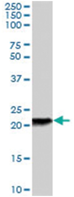 RBP4 Goat anti-Human, Polyclonal Antibody, Abnova 100&mu;g; Unlabeled:Antibodies,
