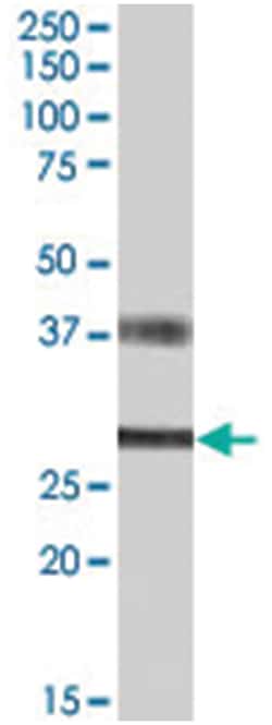 FGF23, Goat, Polyclonal Antibody, Abnova 100 &mu;g | Buy Online | Abnova Corporation | Fisher Scientific