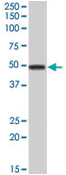 APOA4, Goat, Polyclonal Antibody, Abnova 100 &mu;g | Buy Online | Abnova Corporation | Fisher Scientific