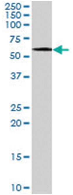 AIRE Goat anti-Human, Mouse, Polyclonal Antibody, Abnova 100&mu;g; Unlabeled:Antibodies,