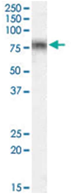 TCF3, Goat, Polyclonal Antibody, Abnova 100 &mu;g | Buy Online | Abnova Corporation | Fisher Scientific