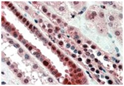 TCF3, Goat, Polyclonal Antibody, Abnova 100 &mu;g | Buy Online | Abnova Corporation | Fisher Scientific