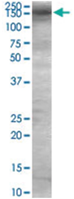 TBC1D4, Goat, Polyclonal Antibody, Abnova 100&mu;g; Unlabeled:Antibodies,