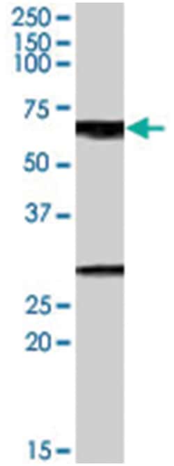 GPSM2, Goat, Polyclonal Antibody, Abnova 100 &mu;g | Buy Online | Abnova Corporation | Fisher Scientific