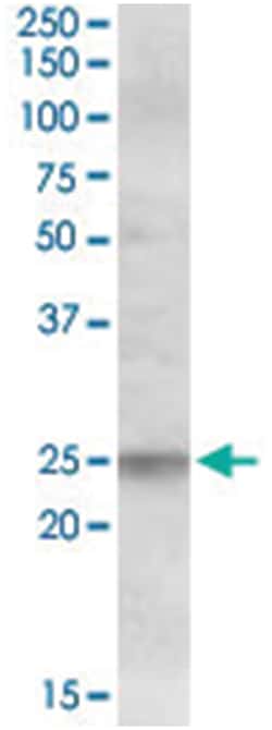 FAIM, Goat, Polyclonal Antibody, Abnova 100 &mu;g | Buy Online | Abnova Corporation | Fisher Scientific