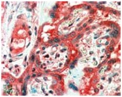 FAIM, Goat, Polyclonal Antibody, Abnova 100 &mu;g | Buy Online | Abnova Corporation | Fisher Scientific