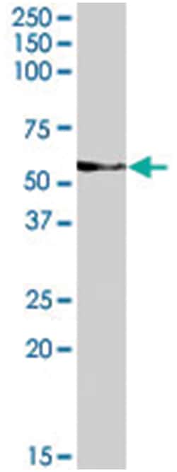 VANGL2, Goat, Polyclonal Antibody, Abnova 100 &mu;g | Buy Online | Abnova Corporation | Fisher Scientific