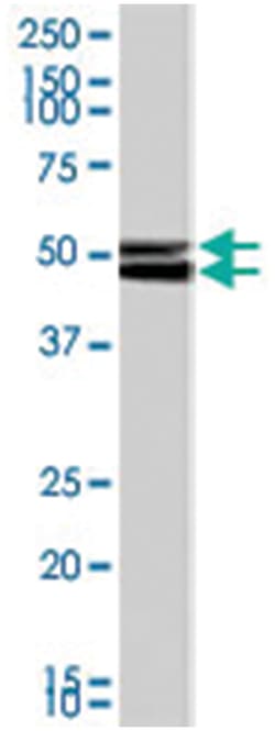Npy2r, Goat, Polyclonal Antibody, Abnova 100 &mu;g | Buy Online | Abnova Corporation | Fisher Scientific
